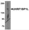UHRF1 Binding Protein 1 Like antibody, 6461, ProSci Inc, Western Blot image 