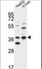 Dehydrogenase/Reductase 3 antibody, LS-C167396, Lifespan Biosciences, Western Blot image 