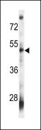 V-set and immunoglobulin domain-containing protein 8 antibody, LS-C157358, Lifespan Biosciences, Western Blot image 