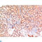 BAX antibody, LS-C813665, Lifespan Biosciences, Immunohistochemistry paraffin image 