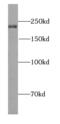 Meiosis Regulator And MRNA Stability Factor 1 antibody, FNab04532, FineTest, Western Blot image 