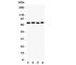 Tyrosine-protein kinase Tec antibody, R31107, NSJ Bioreagents, Western Blot image 