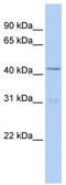 T-Box 10 antibody, TA344484, Origene, Western Blot image 