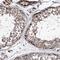 Zinc Finger Protein 487 antibody, HPA037820, Atlas Antibodies, Immunohistochemistry paraffin image 
