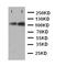 5-azacytidine-induced protein 1 antibody, orb318991, Biorbyt, Western Blot image 