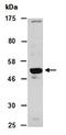 Makorin Ring Finger Protein 1 antibody, orb67219, Biorbyt, Western Blot image 