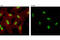Catenin Beta 1 antibody, 5612S, Cell Signaling Technology, Immunocytochemistry image 