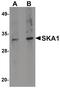 Spindle And Kinetochore Associated Complex Subunit 1 antibody, PA5-20817, Invitrogen Antibodies, Western Blot image 