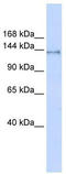 FACT complex subunit SPT16 antibody, TA343665, Origene, Western Blot image 