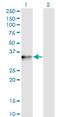 PIH1 Domain Containing 1 antibody, H00055011-M01, Novus Biologicals, Western Blot image 