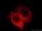 Echinoderm microtubule-associated protein-like 1 antibody, 12765-1-AP, Proteintech Group, Immunofluorescence image 