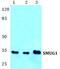 Single-Strand-Selective Monofunctional Uracil-DNA Glycosylase 1 antibody, PA5-75522, Invitrogen Antibodies, Western Blot image 