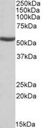 Aldehyde Dehydrogenase 6 Family Member A1 antibody, EB10438, Everest Biotech, Western Blot image 