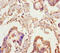 Microtubule Associated Monooxygenase, Calponin And LIM Domain Containing 2 antibody, A59806-100, Epigentek, Immunohistochemistry paraffin image 