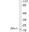 Glutathione Peroxidase 1 antibody, LS-C199873, Lifespan Biosciences, Western Blot image 