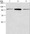 Anaphase Promoting Complex Subunit 2 antibody, LS-C404524, Lifespan Biosciences, Western Blot image 