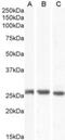 Gap Junction Protein Beta 2 antibody, NB100-57840, Novus Biologicals, Western Blot image 