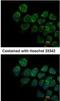 Interferon alpha/beta receptor 2 antibody, NBP1-31665, Novus Biologicals, Immunofluorescence image 