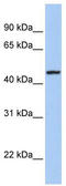 Rod outer segment membrane protein 1 antibody, TA335221, Origene, Western Blot image 