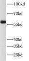 ATPase H+ Transporting V1 Subunit B2 antibody, FNab00718, FineTest, Western Blot image 