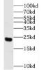 HemK methyltransferase family member 2 antibody, FNab05532, FineTest, Western Blot image 