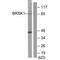 BR Serine/Threonine Kinase 1 antibody, A05997, Boster Biological Technology, Western Blot image 