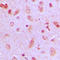 Zinc Finger DHHC-Type Containing 9 antibody, LS-C353431, Lifespan Biosciences, Immunohistochemistry frozen image 