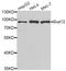 SUZ12 Polycomb Repressive Complex 2 Subunit antibody, LS-C334058, Lifespan Biosciences, Western Blot image 