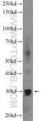 SLX1 Homolog B, Structure-Specific Endonuclease Subunit antibody, 21158-1-AP, Proteintech Group, Western Blot image 