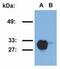 HLA class II histocompatibility antigen, DRB1-15 beta chain antibody, GTX79956, GeneTex, Western Blot image 