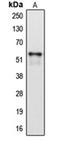 Cytochrome P450 Family 2 Subfamily A Member 6 antibody, orb213819, Biorbyt, Western Blot image 
