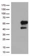 Hepatitis A Virus Cellular Receptor 2 antibody, TA813028, Origene, Western Blot image 