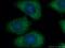Junctional Sarcoplasmic Reticulum Protein 1 antibody, 10854-1-AP, Proteintech Group, Immunofluorescence image 