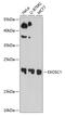 Exosome Component 1 antibody, GTX64871, GeneTex, Western Blot image 