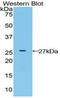 Fibroblast growth factor receptor-like 1 antibody, LS-C293911, Lifespan Biosciences, Western Blot image 