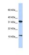 BTF3L1 antibody, orb324612, Biorbyt, Western Blot image 