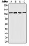 Androgen Receptor antibody, MBS820300, MyBioSource, Western Blot image 