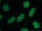 Chromobox 3 antibody, 11650-2-AP, Proteintech Group, Immunofluorescence image 