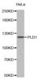 hPLD1 antibody, abx000899, Abbexa, Western Blot image 