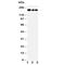ATP Binding Cassette Subfamily C Member 1 antibody, R30717, NSJ Bioreagents, Western Blot image 