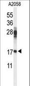 Ribosomal Protein S11 antibody, LS-C162728, Lifespan Biosciences, Western Blot image 