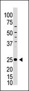 Inducible T-cell costimulator antibody, AP13108PU-N, Origene, Western Blot image 