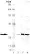 Superoxide Dismutase 2 antibody, GTX13533, GeneTex, Western Blot image 