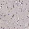 FA Complementation Group D2 antibody, orb48374, Biorbyt, Immunohistochemistry paraffin image 