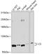 Complement C5 antibody, A00156, Boster Biological Technology, Western Blot image 