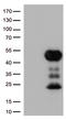 CD32a antibody, LS-C796732, Lifespan Biosciences, Western Blot image 