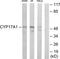 Cyp17 antibody, TA311723, Origene, Western Blot image 