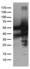 Catalase antibody, TA502496, Origene, Western Blot image 