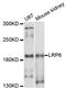 Low-density lipoprotein receptor-related protein 6 antibody, LS-C748714, Lifespan Biosciences, Western Blot image 