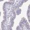 Dynein Axonemal Heavy Chain 14 antibody, NBP2-38182, Novus Biologicals, Immunohistochemistry paraffin image 